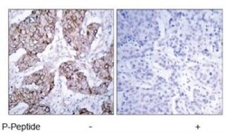 EGFR, p Tyr1092 Antibody, Novus Biologicals:Antibodies:Primary Antibodies